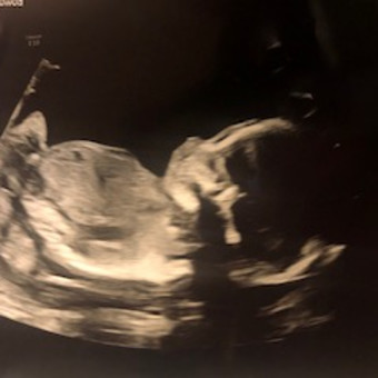 Babylist Registry Photo.
