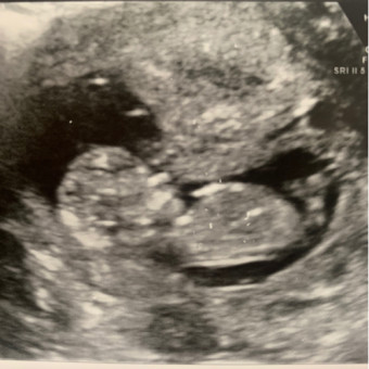 Babylist Registry Photo.
