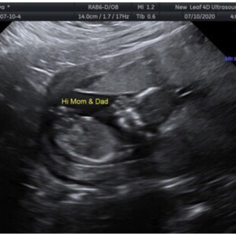Babylist Registry Photo.