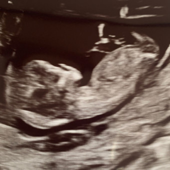 Babylist Registry Photo.