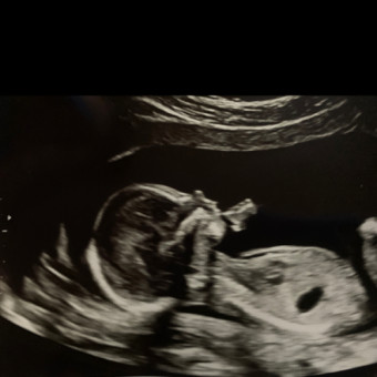 Babylist Registry Photo.
