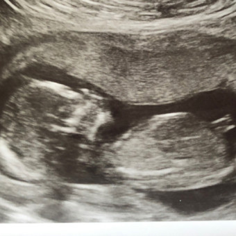 Babylist Registry Photo.