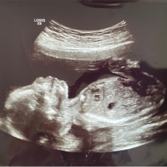 Babylist Registry Photo.