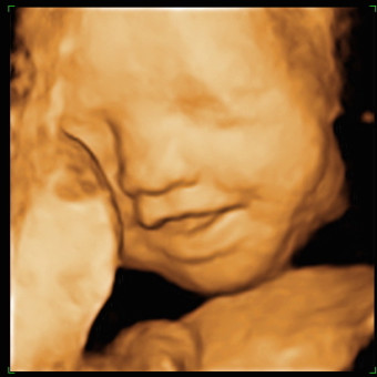 Babylist Registry Photo.