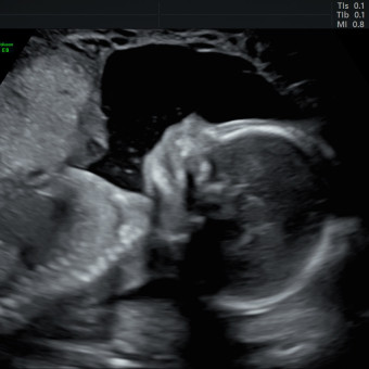 Babylist Registry Photo.