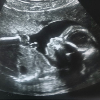 Babylist Registry Photo.