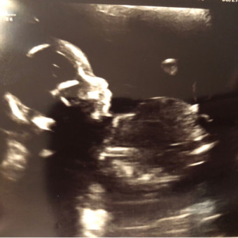 Babylist Registry Photo.