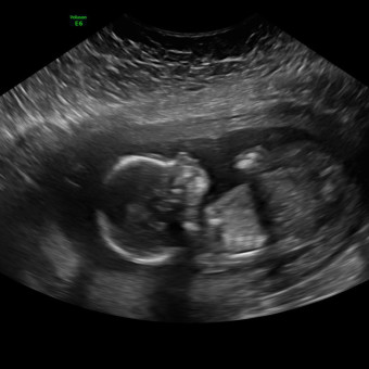 Babylist Registry Photo.