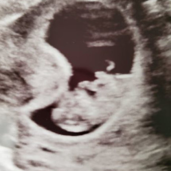 Teri Haddox And Barry Moran S Baby Registry At Babylist Tel find other people with the last name barry in lathrop, ca >>> find all people with. baby registry at babylist