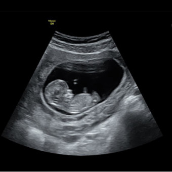 Babylist Registry Photo.