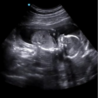 Babylist Registry Photo.