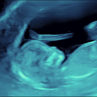 Babylist Registry Photo.