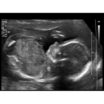 Babylist Registry Photo.