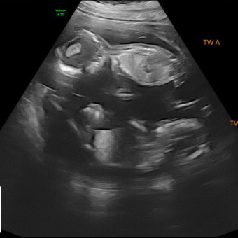 Babylist Registry Photo.