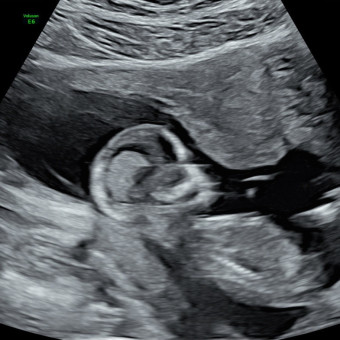 Babylist Registry Photo.