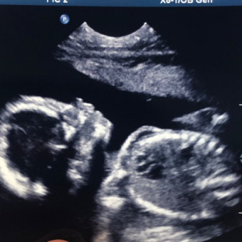 Babylist Registry Photo.