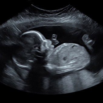 Babylist Registry Photo.