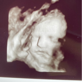 Babylist Registry Photo.