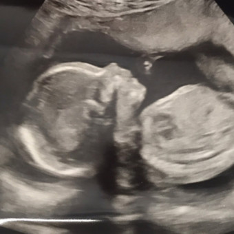 Babylist Registry Photo.