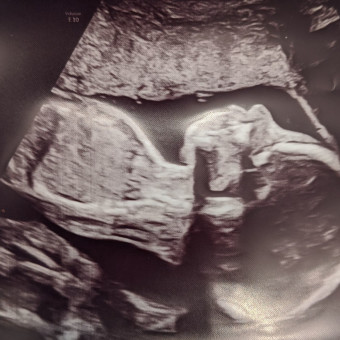 Babylist Registry Photo.