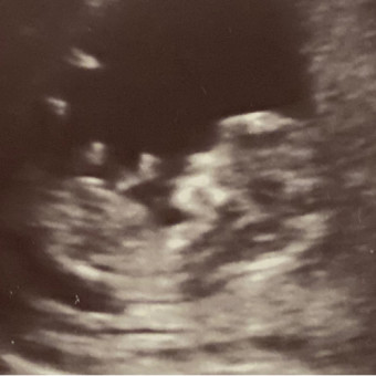 Babylist Registry Photo.