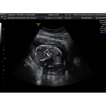 Babylist Registry Photo.