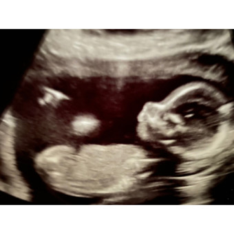 Babylist Registry Photo.