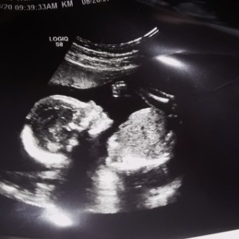 Babylist Registry Photo.