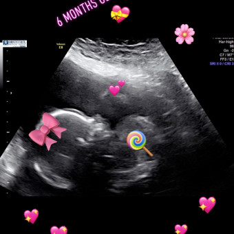Babylist Registry Photo.