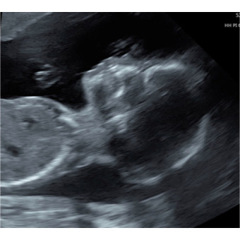 Babylist Registry Photo.