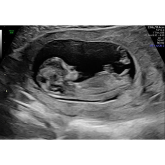Babylist Registry Photo.