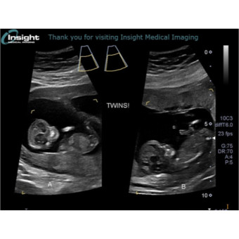 Babylist Registry Photo.