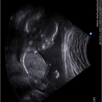 Babylist Registry Photo.