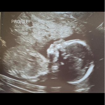 Babylist Registry Photo.