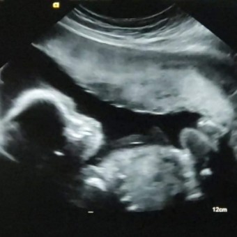Babylist Registry Photo.