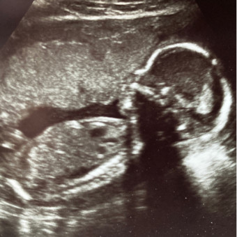Babylist Registry Photo.
