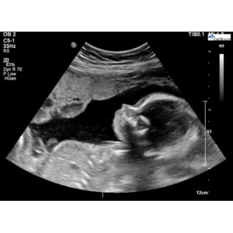 Babylist Registry Photo.