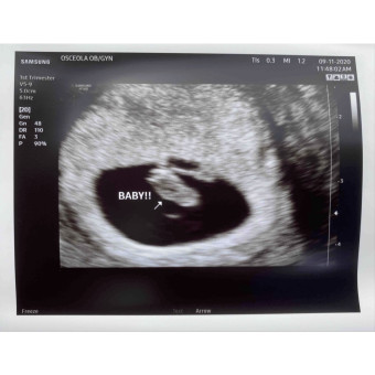 Babylist Registry Photo.