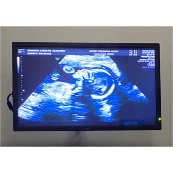 Babylist Registry Photo.