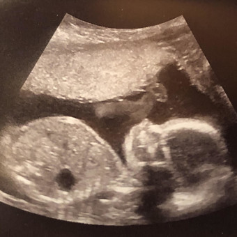 Babylist Registry Photo.