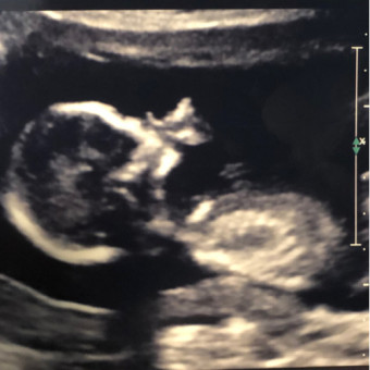 Babylist Registry Photo.