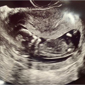 Babylist Registry Photo.