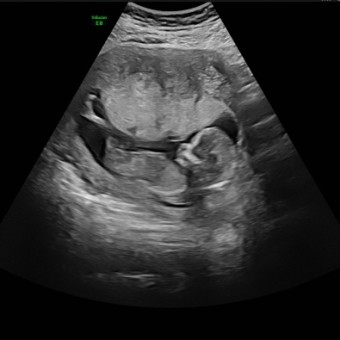 Babylist Registry Photo.