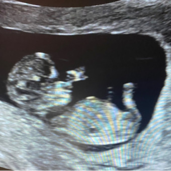 Babylist Registry Photo.