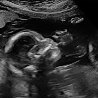 Babylist Registry Photo.