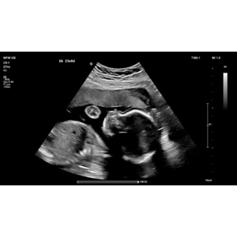 Babylist Registry Photo.