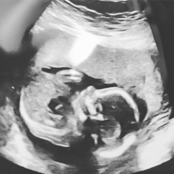 Babylist Registry Photo.