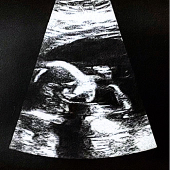 Babylist Registry Photo.