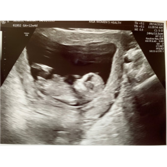 Babylist Registry Photo.