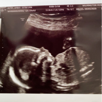 Babylist Registry Photo.